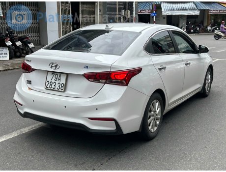79A-283.38, Hyundai Accent